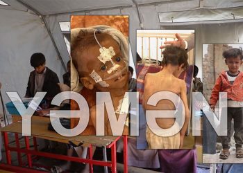 7 ildir Səudiyyə koalisiyası və ABŞ yəmənli körpələri qətliam edir! – Video